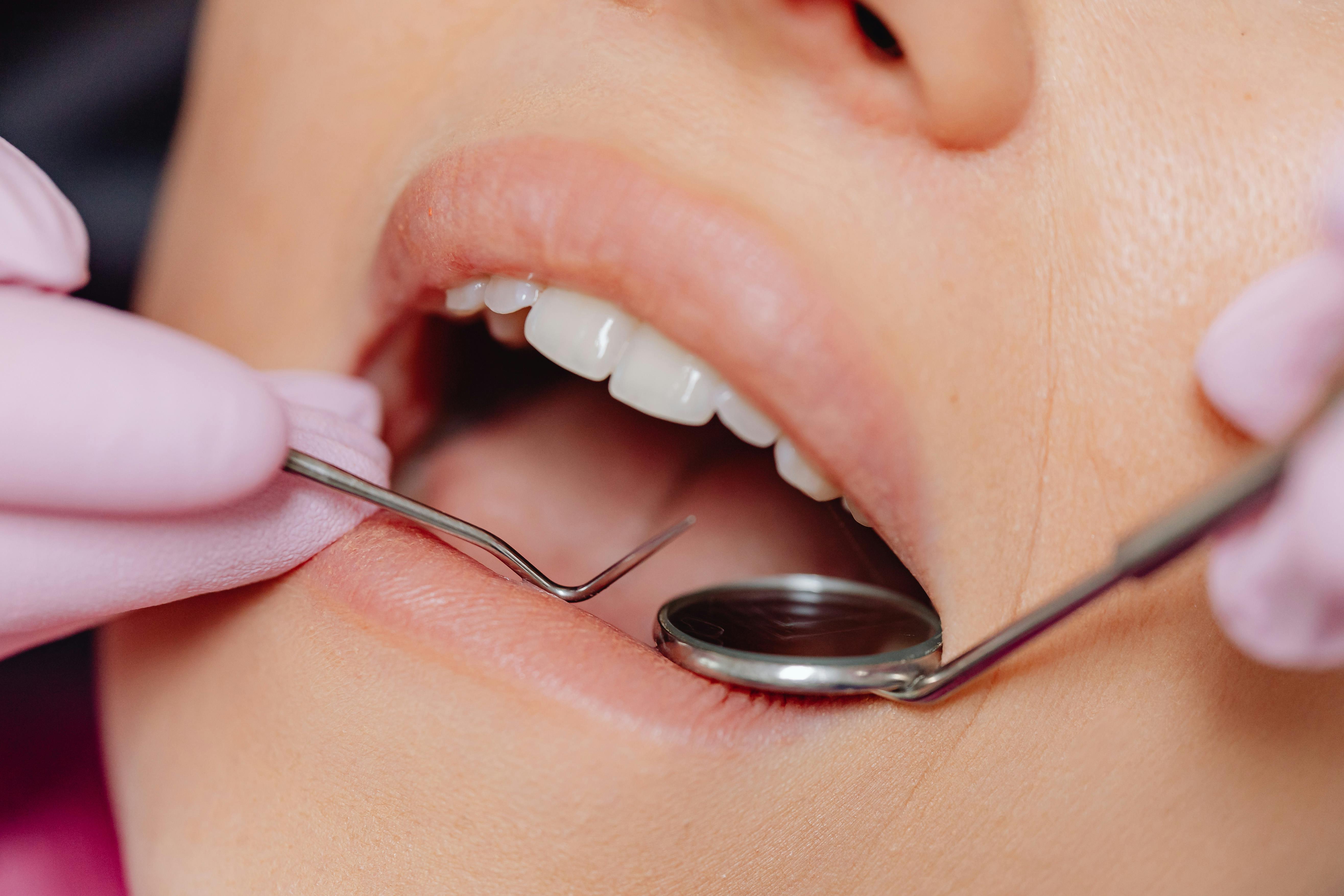 Revisión periodontal para el cuidado de dientes y encías